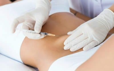 Gezielt Fettpolster reduzieren – Fett-weg-Spritze in Bad Nauheim