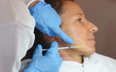 Faltenreduzierung – natürlich schön bleiben