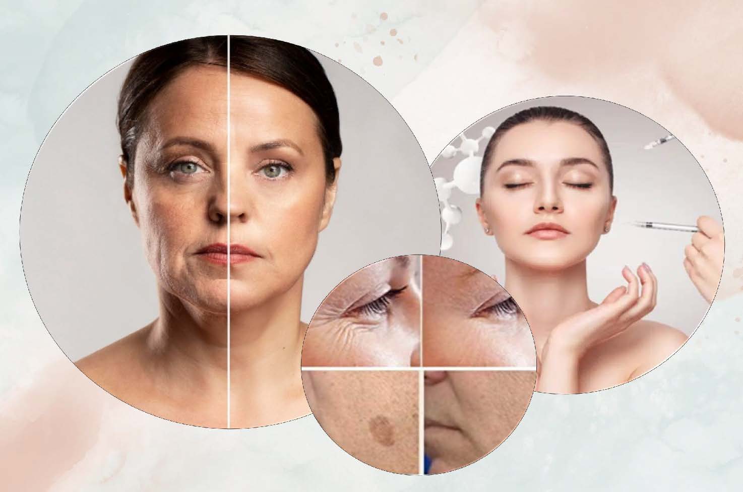 Sanfte Faltenbehandlung und Glow in Bad Nauheim